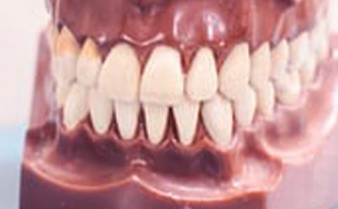 ���l�[ʹ�����X�Ʉ�(d��ng)��ע�����(xi��ng)��ʲô