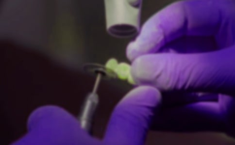 拔牙后出血多久可刷牙?注意事項(xiàng)有哪些