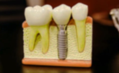 ����ӛ����[����12ƪ]