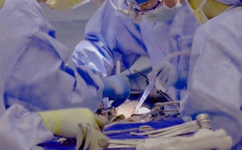 即將到來的手術(shù)作文