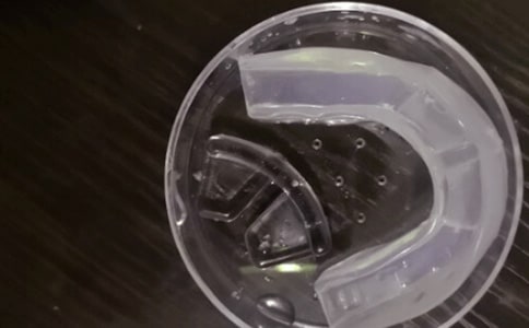 有關(guān)上牙套的散文