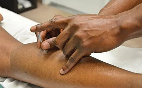 中心視網(wǎng)膜病變針灸治療