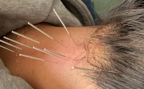 針灸科年度工作總結(jié)